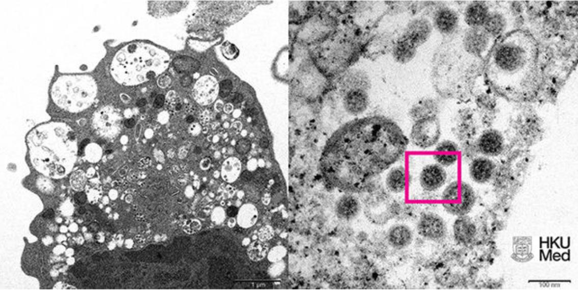 香港大学公布的Omicron变种病毒显微镜下成像