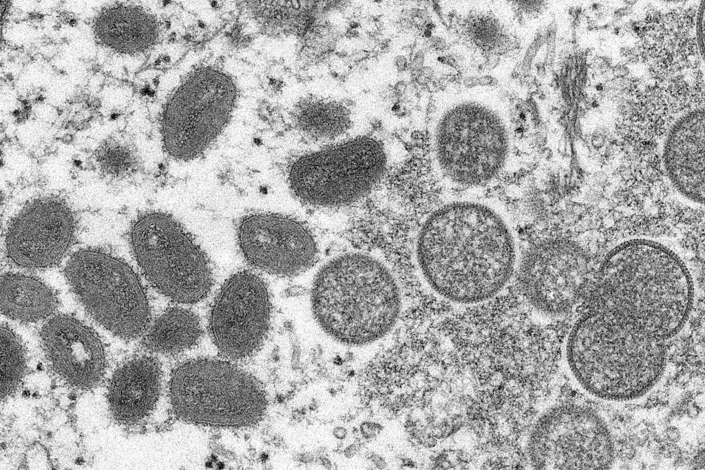 成熟猴痘病毒(左)和未成熟病毒粒子(右) 电子显微镜图像